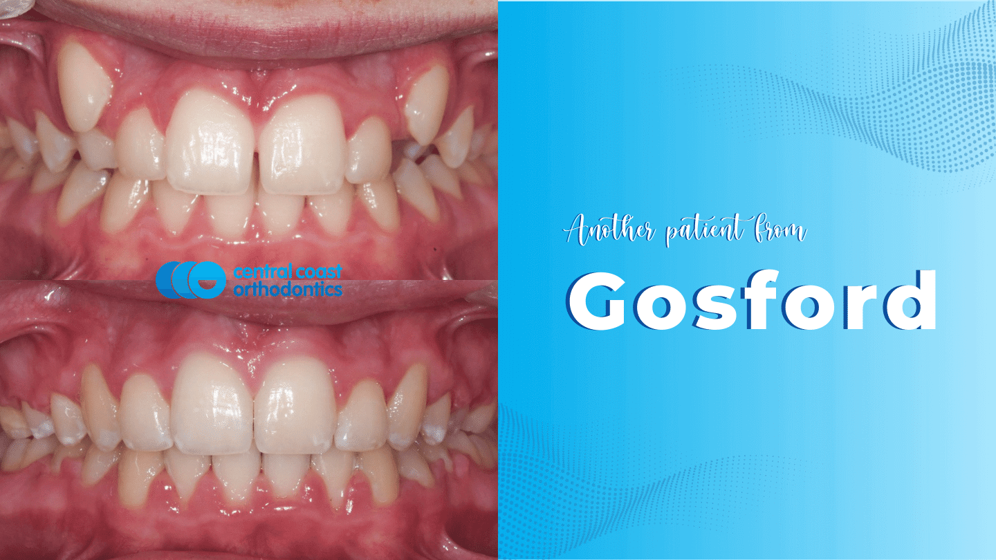 CCO Patient 3