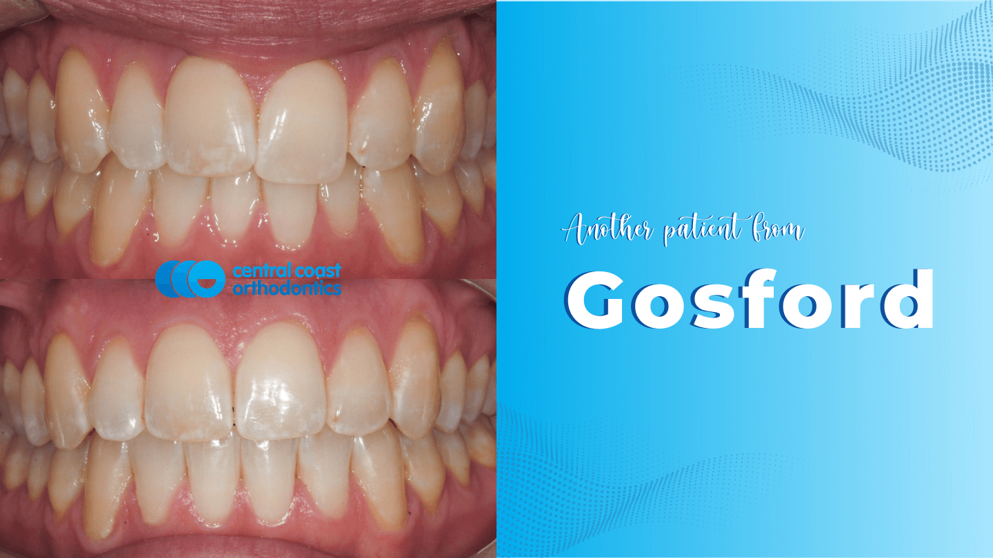 CCO Patient 2