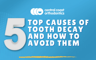 5 Top Causes of Tooth Decay and How to Avoid Them
