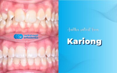 Patient of Kariong’s Braces Makeover