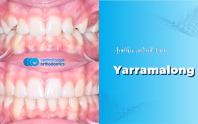 Patient of Yarramalong’s Braces Makeover