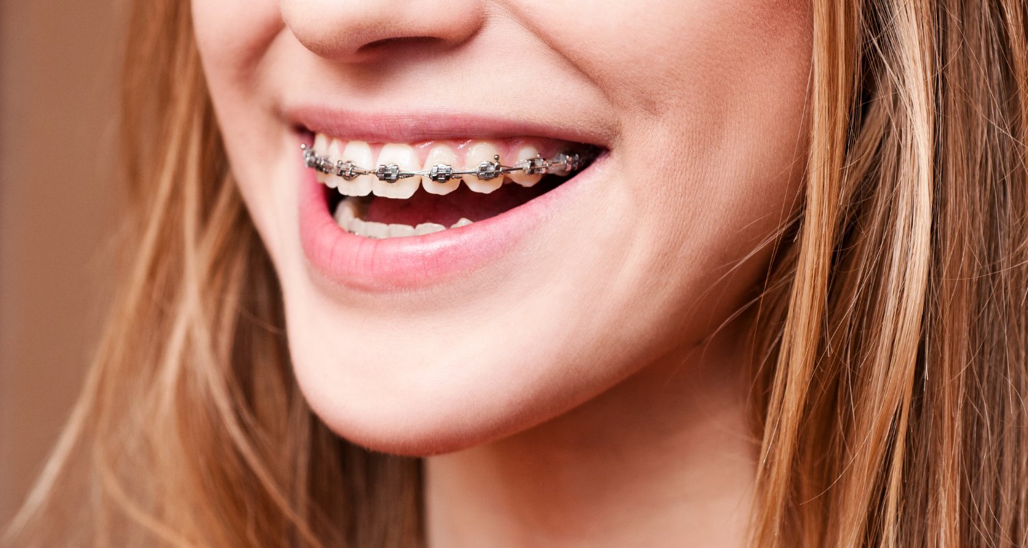 True Emergency or Minor Hiccup Understanding When Your Orthodontic Issue Needs Immediate Attention
