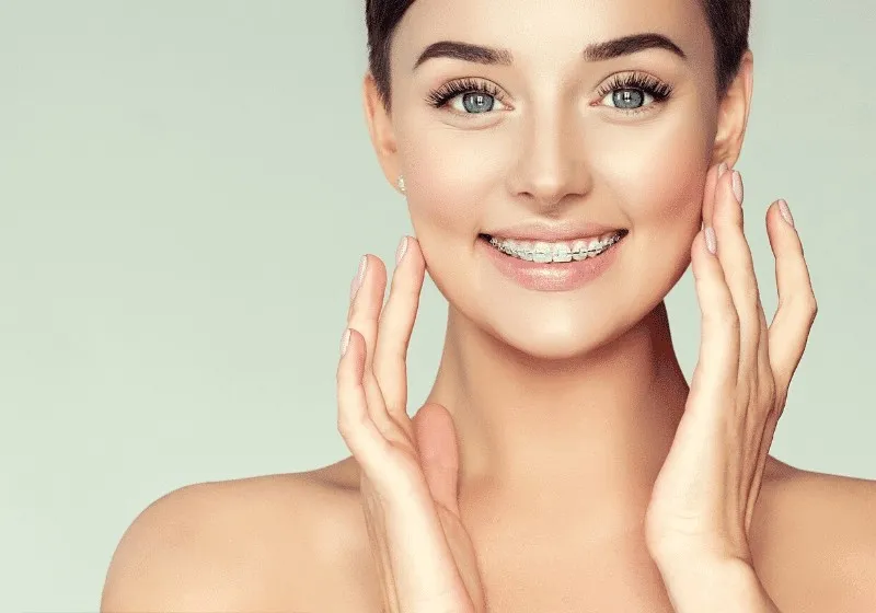 Smiling young woman with ceramic braces framing her face with her hands